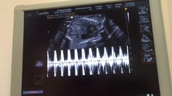 Julián no quiere perderse ningún momento del embarazo, por eso utilizaron la tecnología para que estuviera presente en el ultrasonido: "Así escucharon hoy mi corazón 😍 emocionado por ver a mi mamá, también estaba mi abuelita, mi papá que nos llamó por FaceTime y me vio también mi carita hermosa. No tenía muchas ganas de moverme, estoy un poco agotado de trabajar con mamá", publicó en Instagram.