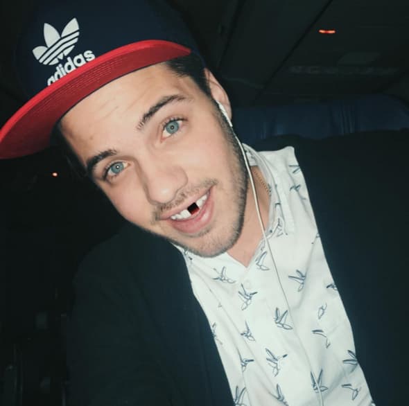 William mostrando solidaridad a J Balvin y su diente roto. (Febrero 6, 2016)