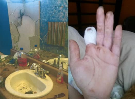 Daños ocasionados por la explosión de un cigarro electrónico.