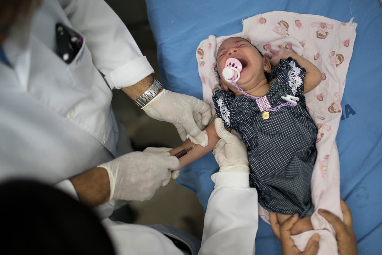 Un doctor le saca sangre a Luana, quien nació con microcefalia, en un hospital de Recife.