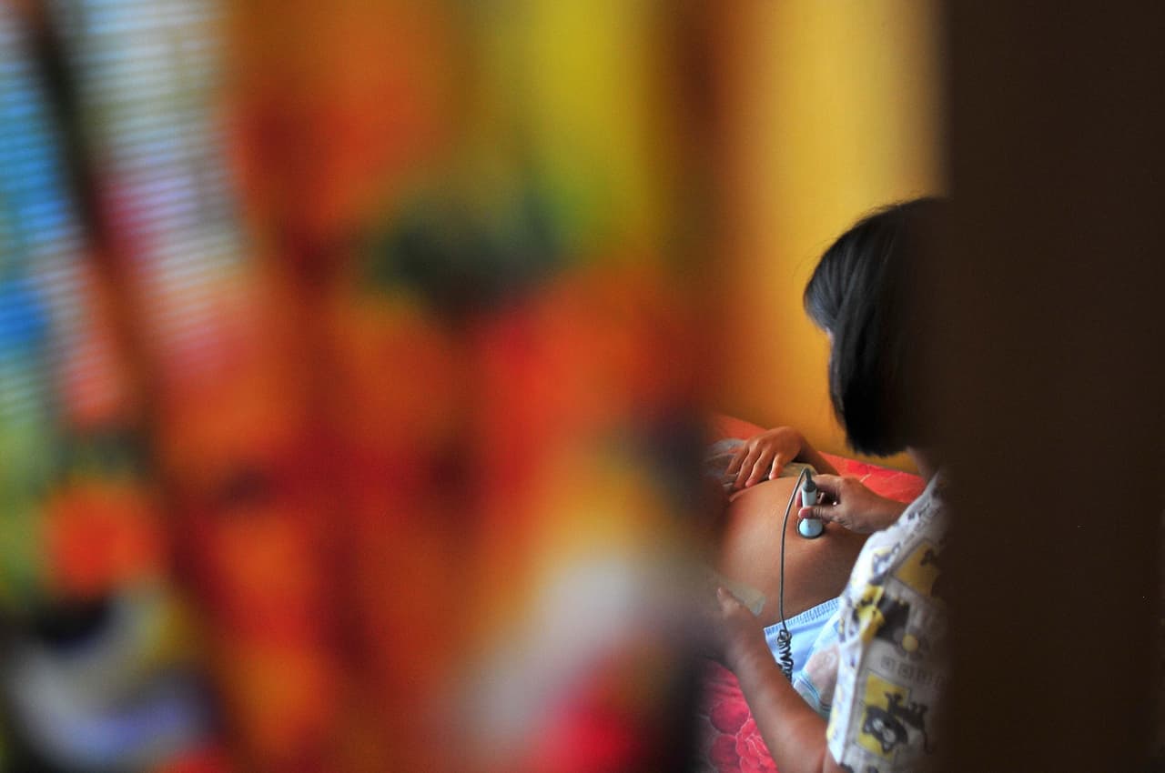 En Estados Unidos cada año hay aproximadamente 500 casos de Trisonomía 13.