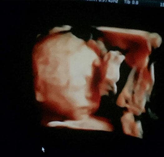 Hace unos días compartió con sus seguidores su más reciente ultrasonido: "¡Les presento a mi amor bebé! ¡MARCELO! Duerme como su papá @pipooff con la mano en la cara y vean su pierna hará Yoga como yo".