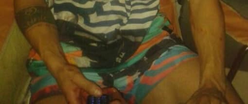 También los brazos y manos tenía rastros de sangre y pequeños golpes.