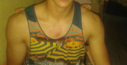 También se le notaron algunos rasguños y golpes en el pecho.