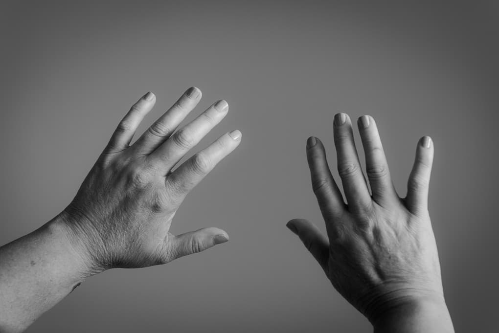 La esclerodermia sistémica ocurre cuando el sistema inmunitario ataca por error al tejido corporal sano y lo destruye. Hasta ahora se desconoce la causa.