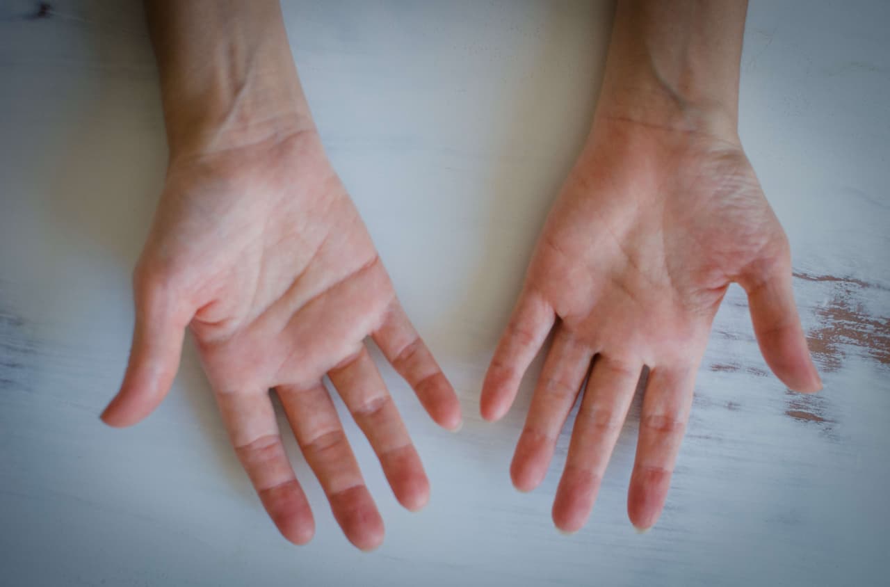 "Amo mis manos, con sus inflamaciones, callos y dolores intensos".