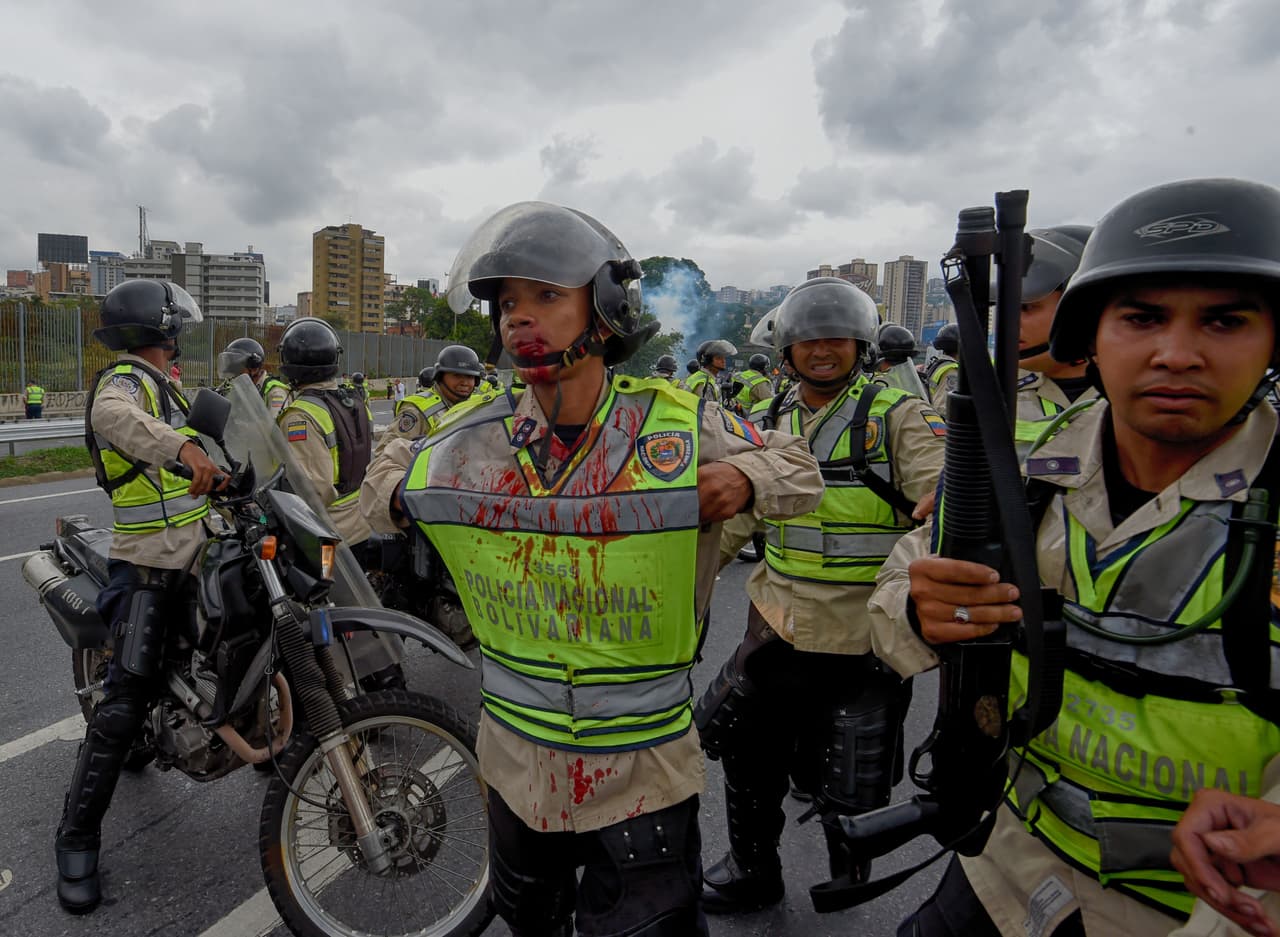 Un funcionario de la Policía Nacional Bolivariana de Venezuela, manchado de sangre.