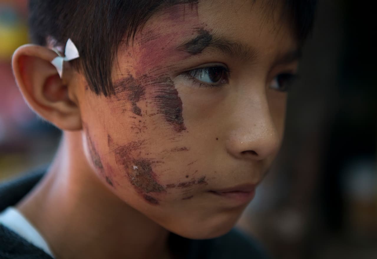 Josué y Alan, los niños que 'volvieron a nacer' entre escombros tras el terremoto en México