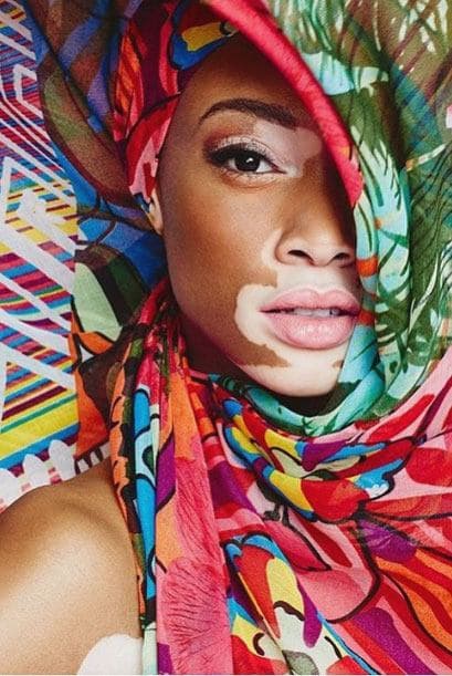 Esta belleza de mujer ha inspirado a muchas mujeres, demostrando que nada es impedimento para brillar.