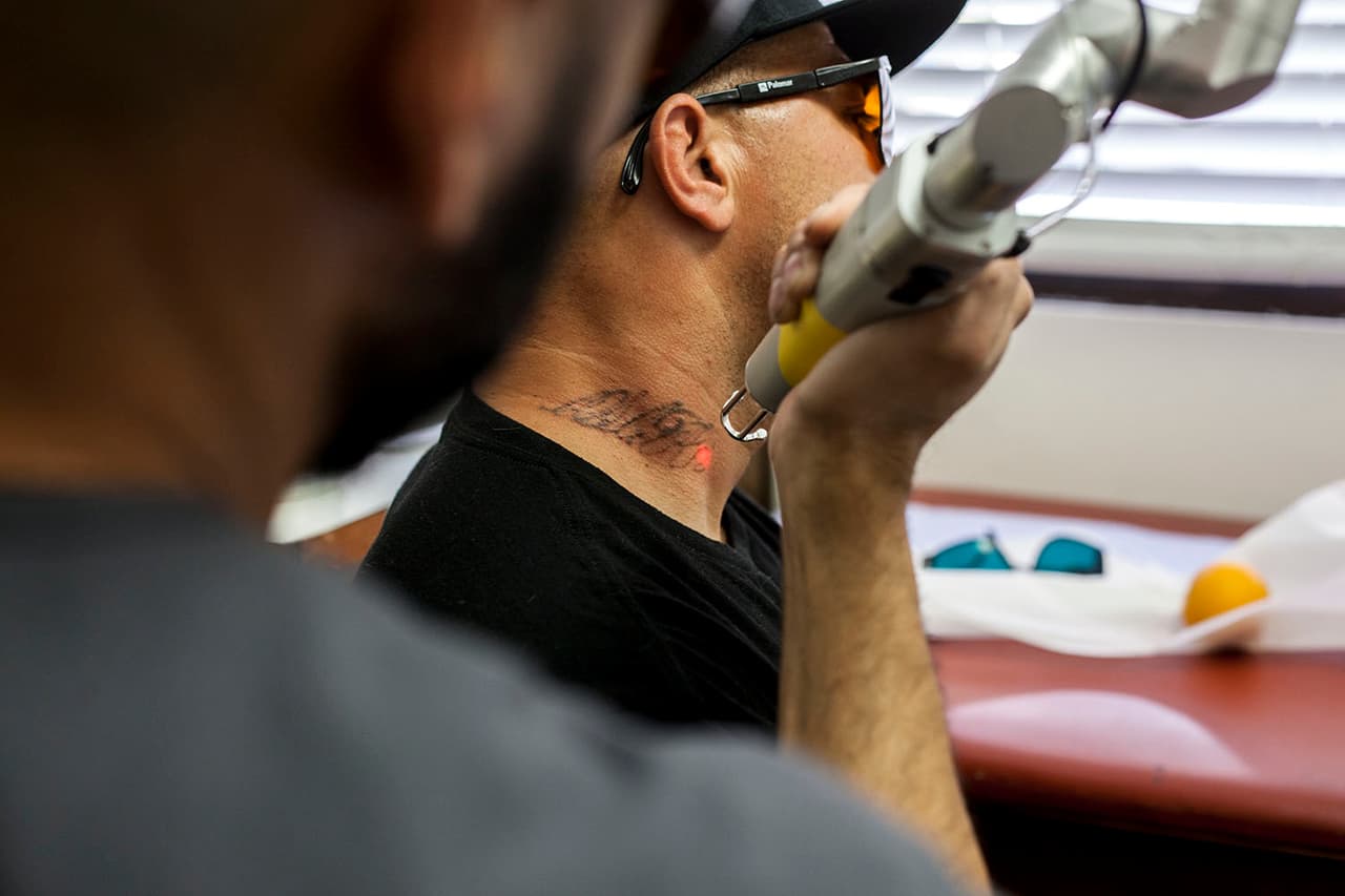 Los tatuajes visibles en cara, manos, brazos y cuellos son los más urgentes de remover cuando los expandilleros quieren conseguir trabajo.