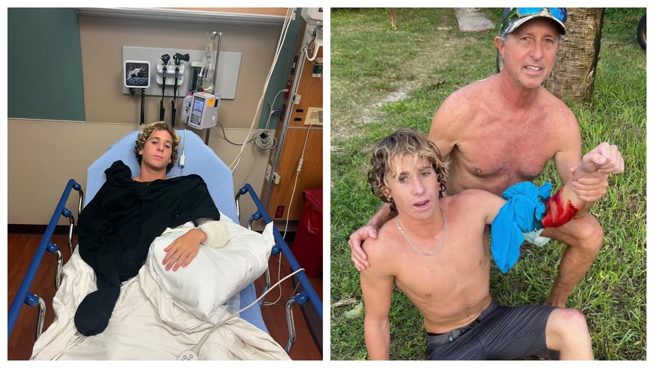 "Lo vi en la parte interna de mi brazo": Surfista adolescente relata cómo sobrevivió al ataque de un tiburón en Florida