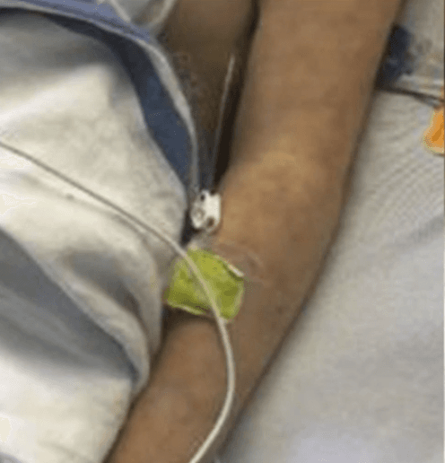 Se trata del síndrome inflamatorio multisistémico, una afección que puede aparecer de dos o tres semanas después del contagio de covid-19.