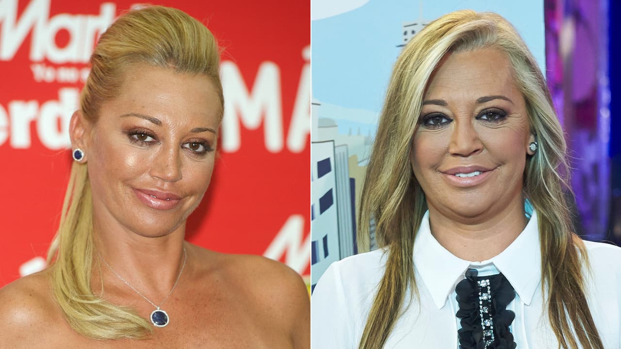 <b>Belén Esteban</b>: es una celebridad de la televisión española que, se hizo famosa por su relación con el torero Jesulín de Ubrique. A través de los años ha cambiado su rostro por las operaciones en las que se ha sometido.
<br>