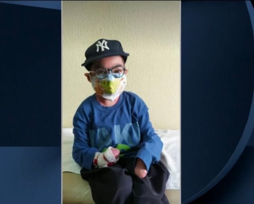 Ángel no titubea al nombrar el motivo por el que pide ayuda a toda la gente que quiera darle una mano. "Quiero que me ayuden a escuchar otra vez a mi mamá", comenta. 
<br>
<br>