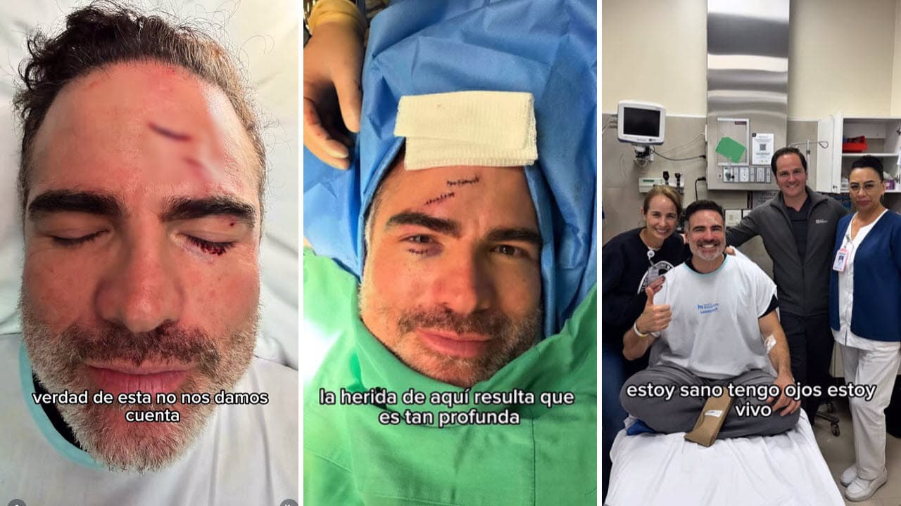 Roberto Manrique compartió imágenes de las heridas.