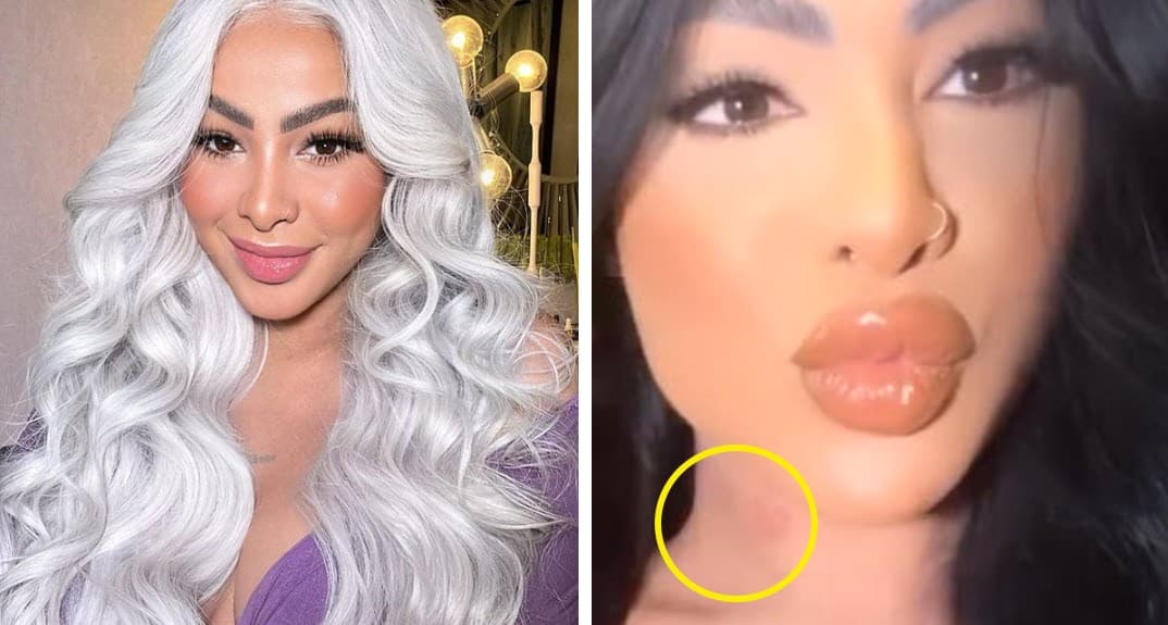 Yailin La Más Viral desata polémica por aparente marca en el cuello