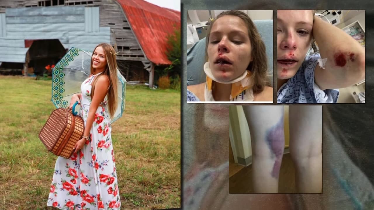 "Vas a hacer lo que yo diga": relato de la conductora de Uber que se  lanzó del auto para salvar su vida