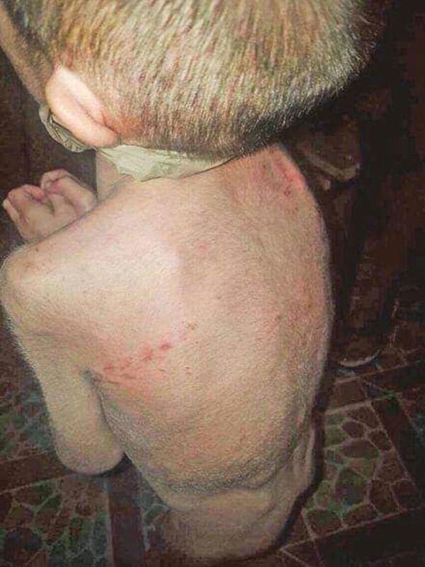 Antony, el niño maltratado en México, volverá a EEUU en dos semanas, según su padre