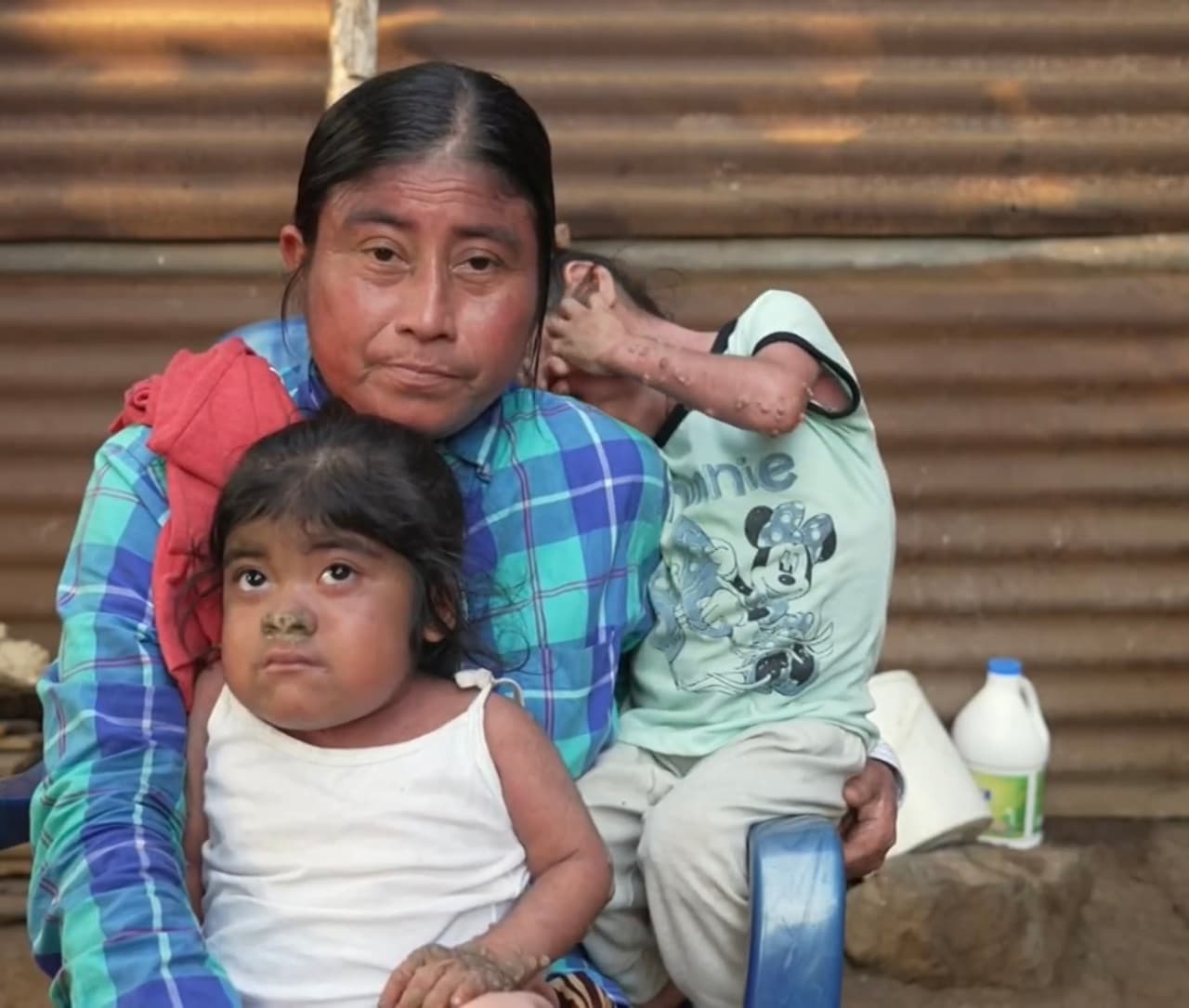 Sin embargo, la extrema pobreza de la familia impide que puedan sortear esos gastos. “A veces me pongo a llorar y le pido a Dios que se compadezca de mí”, dice Rolando, quien sueña con un futuro mejor para sus hijas.
<br>