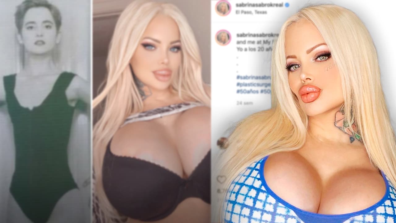 Sabrina tiene ahora labios gigantes que le costaron 3 mil dólares, pero "ya no puede reír"