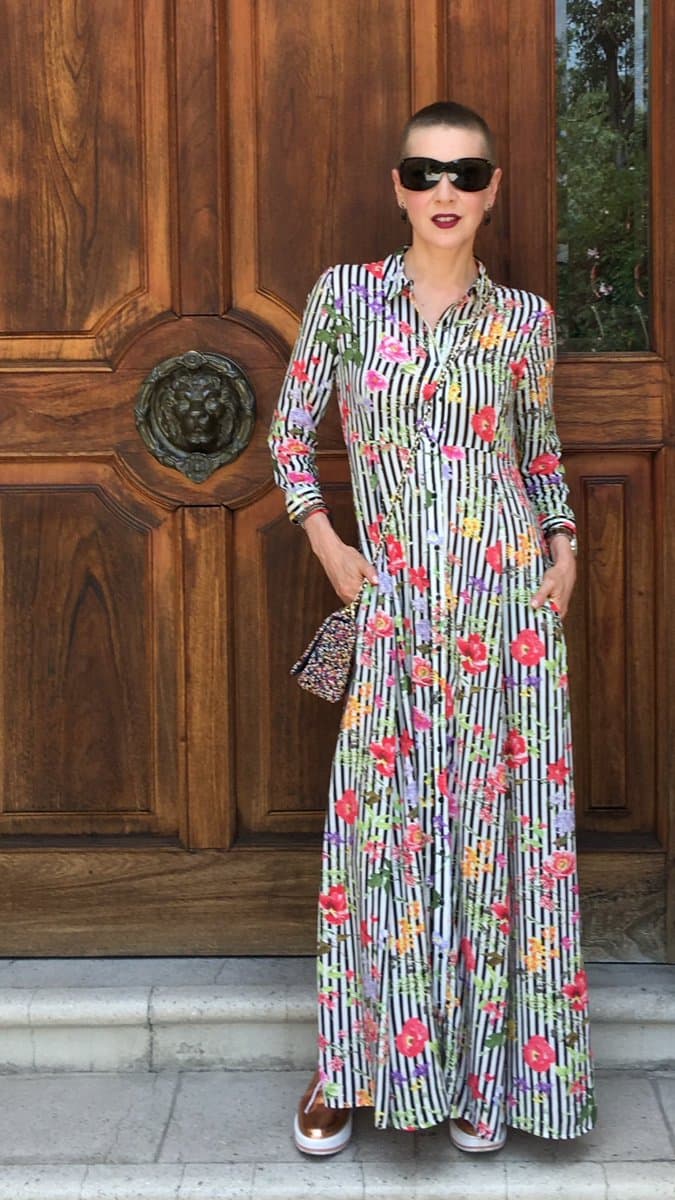 En dicha entrevista dijo que no usará pelucas nunca más, pues además de ser muy costosas son incómodas y le causan lesiones en la nuca "Las pelucas oncológicas son muy caras, son pelucas especializadas, con una tecnología especializada, no las encuentras en ningún lado".