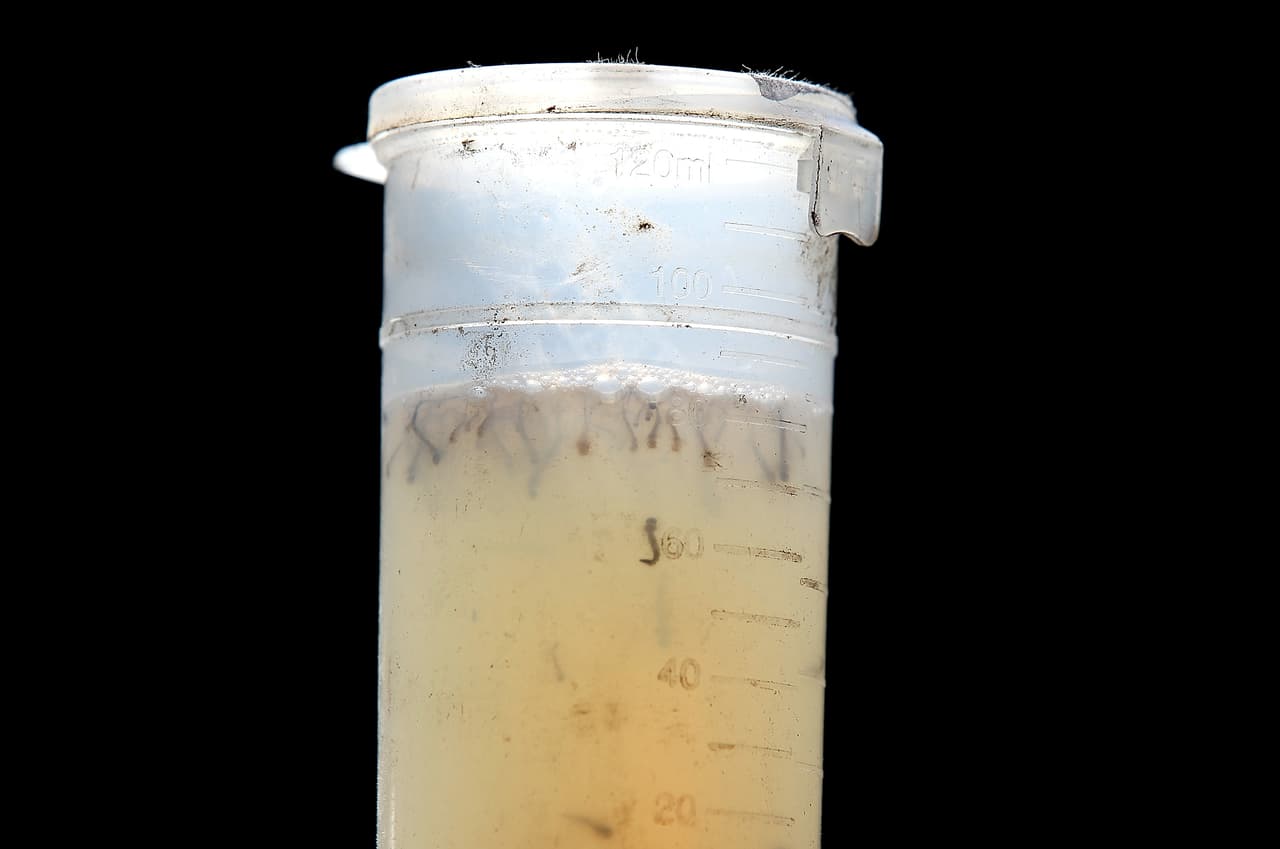 Las personas mayores de 50 años y las que tienen problemas de salud preexistentes son más vulnerables a sufrir complicaciones por esta enfermedad e incluso la muerte.