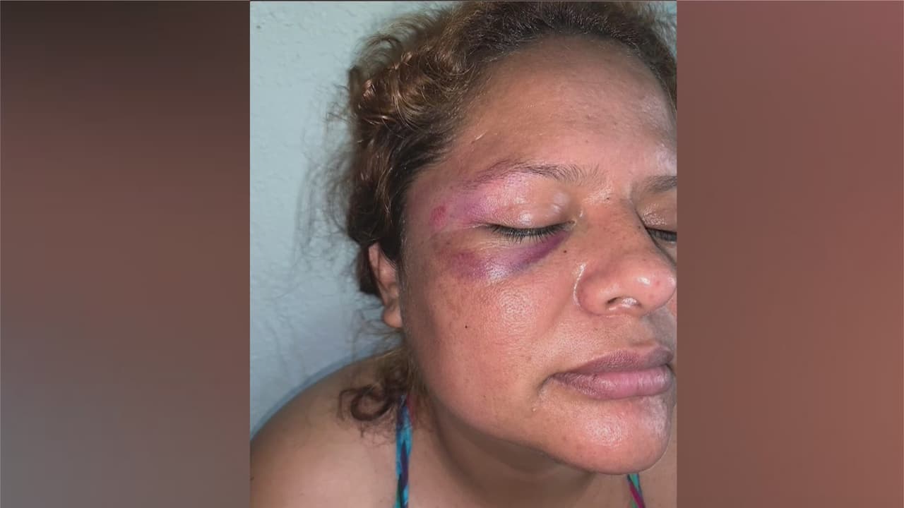 Vendedora ambulante queda inconsciente en la calle tras ser atacada por un hombre