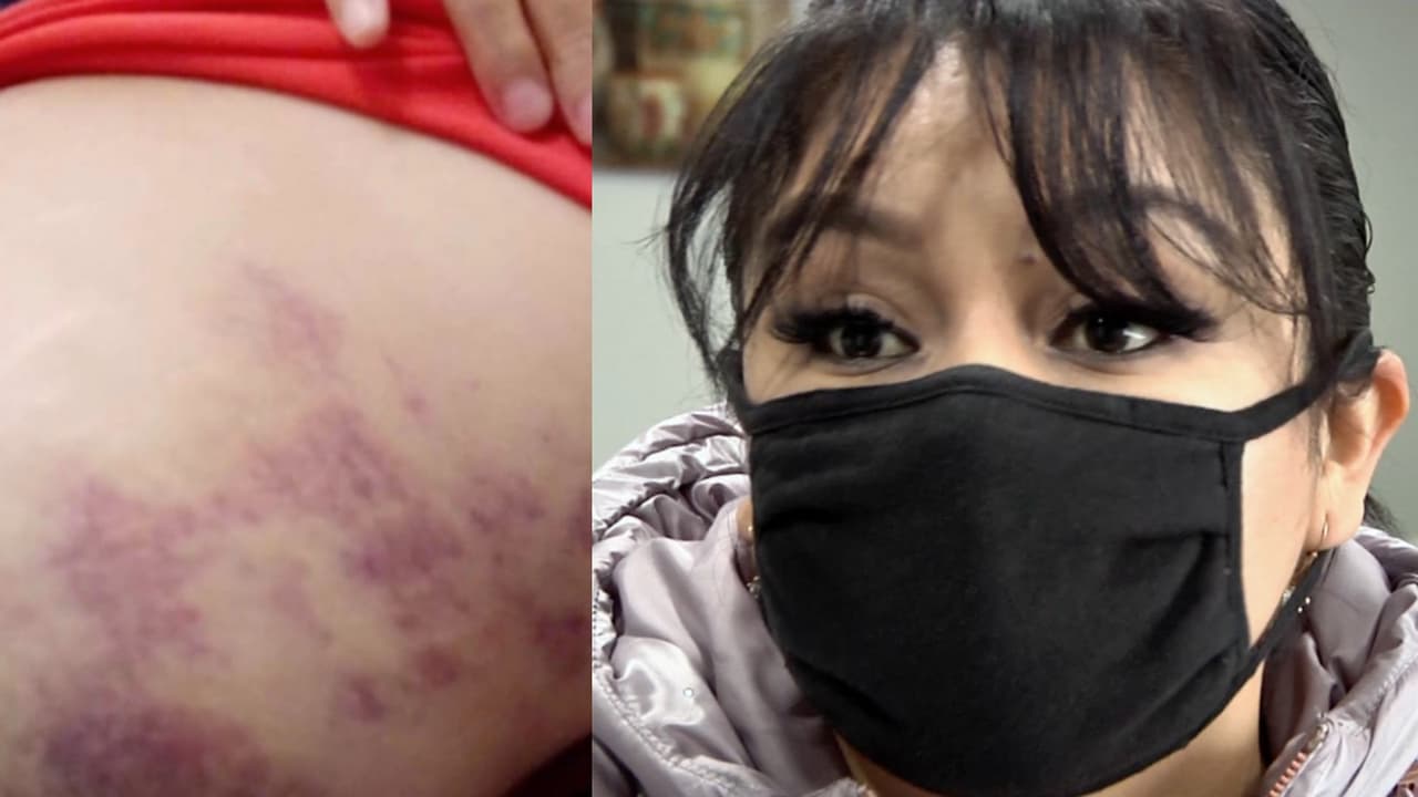 Hospital cubre gastos de paciente que sacó de sus instalaciones a los 90 minutos de operada