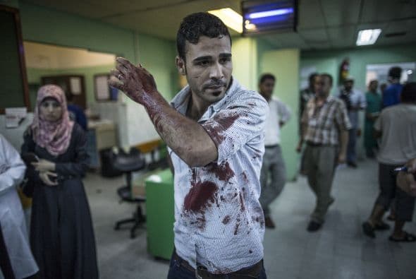 Al menos 600 palestinos han muerto hasta este martes en Gaza a causa del conflicto armado entre Israel y Hamas. Una estimación de las Naciones Unidas señala que casi ocho de cada 10 de las víctimas son civiles. Cifras del Ministerio de Salud de Gaza reportan que más de 3 mil 700 han quedado heridos. Mientras Israel ha informado que sus fuerzas armadas han matado a más de 180 militantes, reportando la baja de 27 de sus soldados.