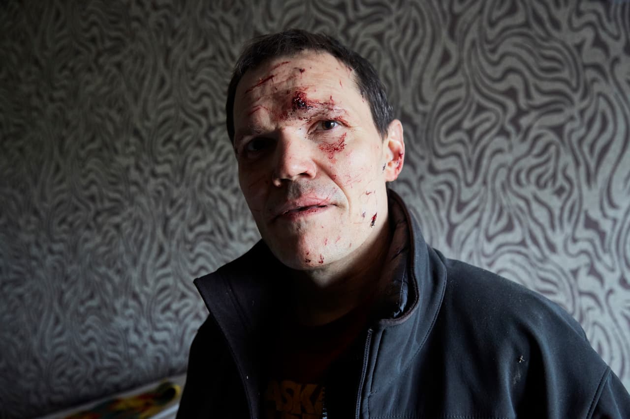 Vladimir recoge sus pertenencias en su habitación dañada por un misil lanzado por Rusia la madrugada de este viernes en Kiev, Ucrania. Vladimir fue herido en la cara por la explosión de una ventana.