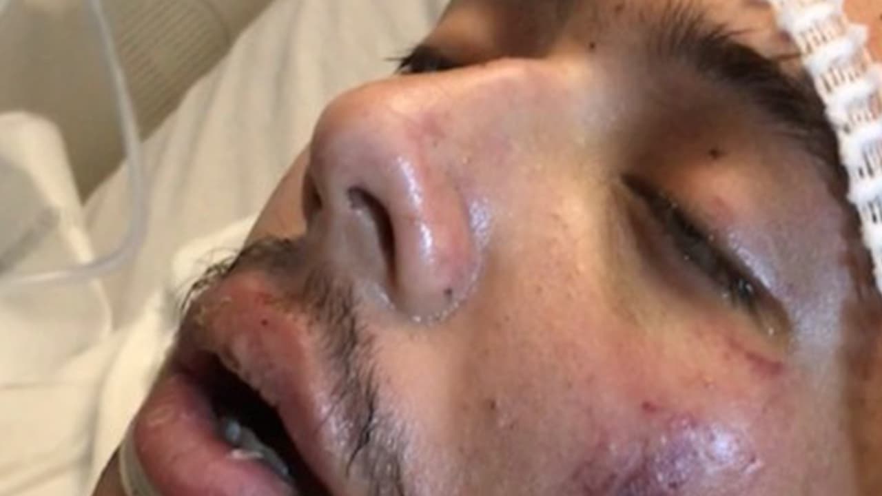 La familia agradece el apoyo y las oraciones recibidas y ha habilitado una cuenta de GoFundMe (Jonathan Garcia - unexpected horrific accident) para los gastos del hospital y lo que requerirá cuando regrese a casa.