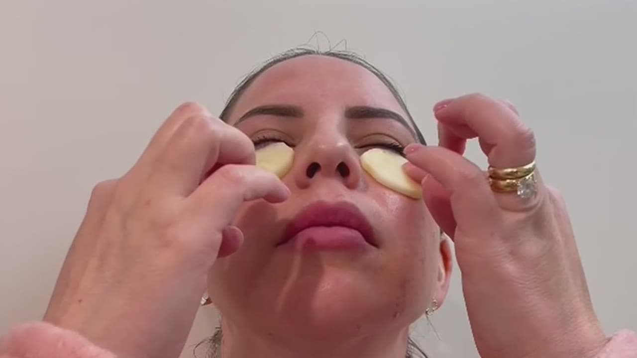 Mascarillas caseras para disimular las bolsas de los ojos