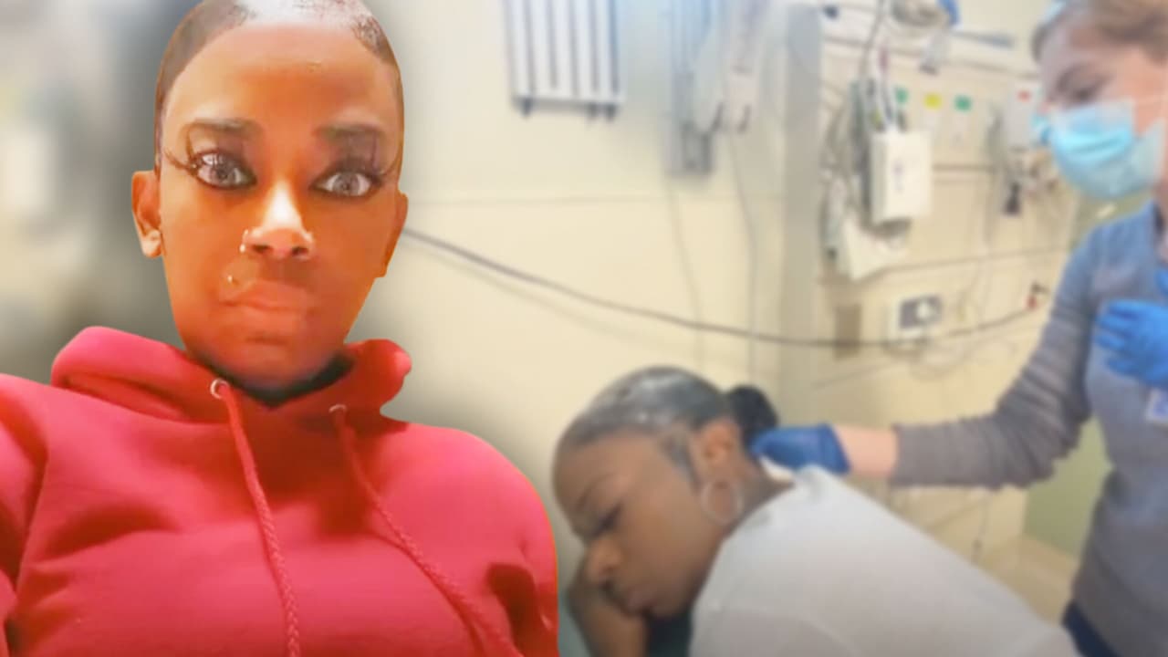 La chica que usó Gorilla Glue en el pelo dona 20 mil dólares a quienes necesitan cirugía reconstructiva
