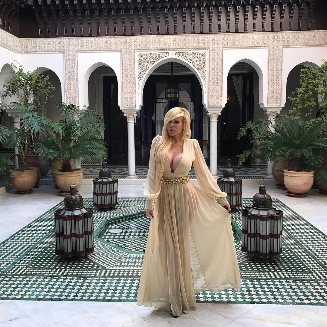 El médico identificó que tiene tatuadas las cejas, utiliza bótox, en sus labios se aplicó ácido hialurónico o colágeno y también podría tener una rinoplastia.