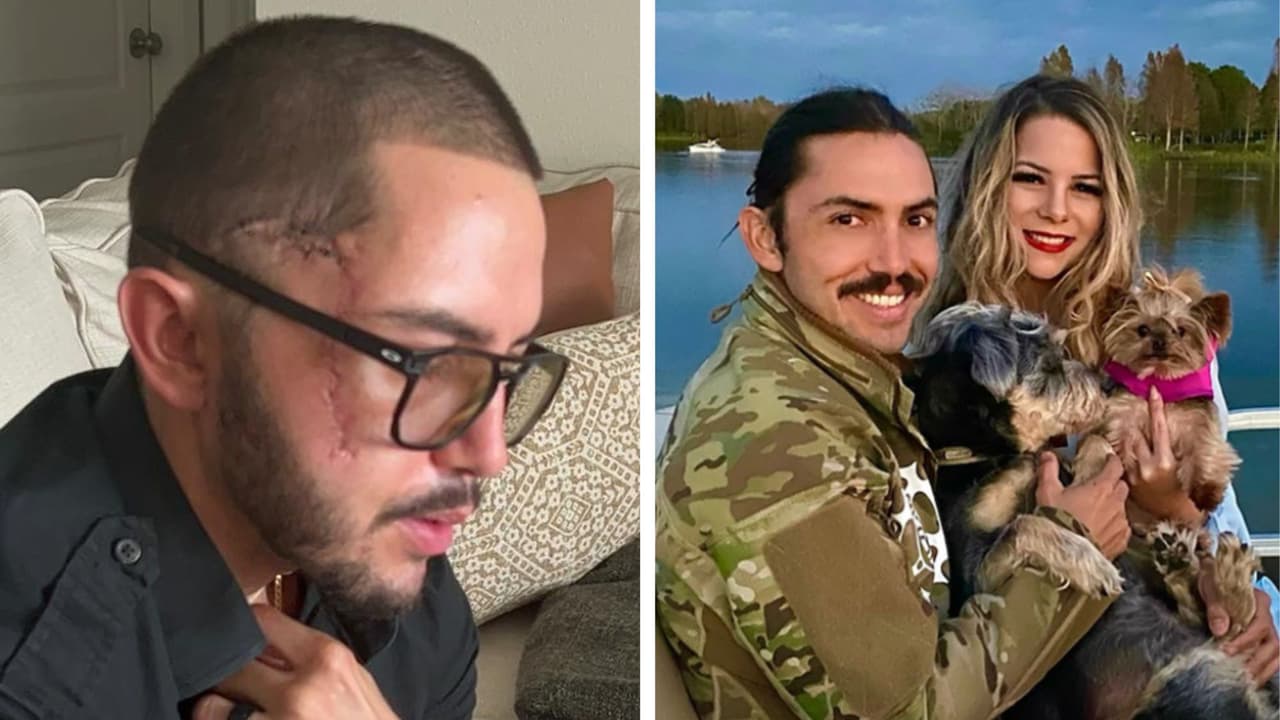 "Sentí los dientes y oí mi mandíbula quebrarse": Hispano que sobrevivió al ataque de un caimán en Florida