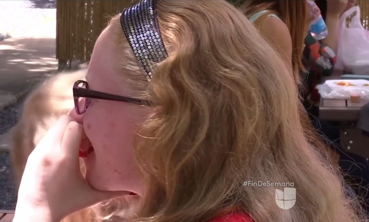 Puerto Rico y su alta tasa de albinismo