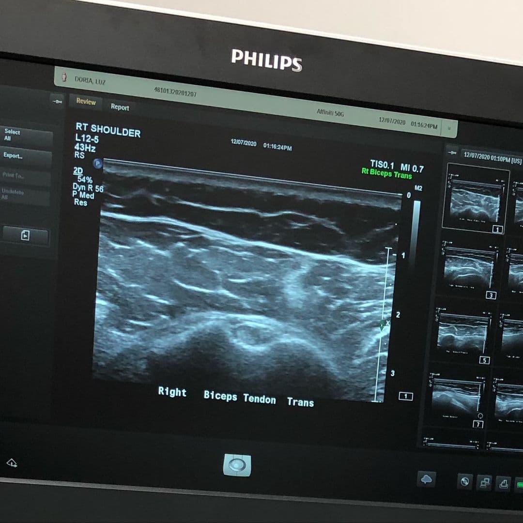 Esta imagen es del brazo derecho de nuestra productora Luz María Doria, el mismo con el que ha ejecutado grandes y maravillosos proyectos, y que ahora le está pidiendo un poquito de cuidados, para poder seguir con ellos adelante.