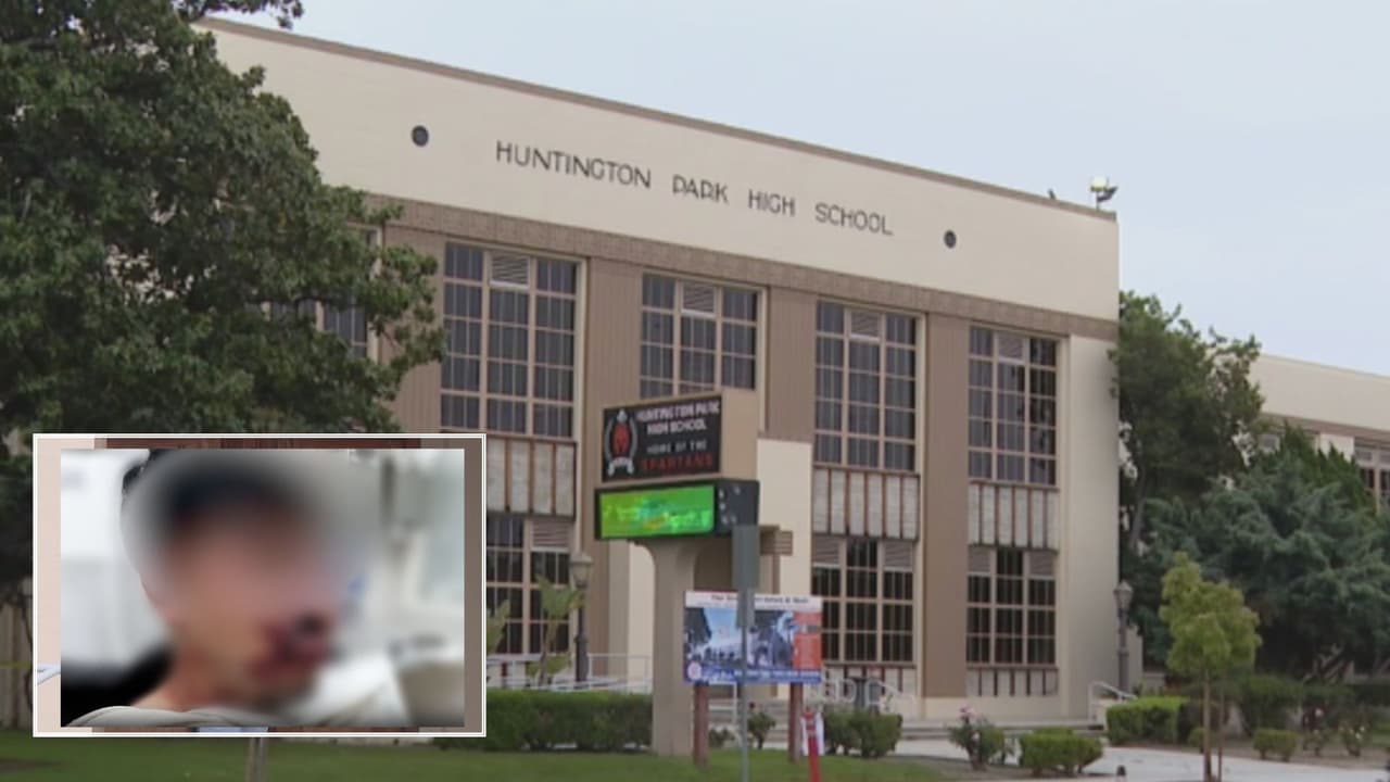 “Mi hijo no puede ni dormir”: Madre hispana dice que su hijo fue golpeado hasta quedar inconsciente en su escuela