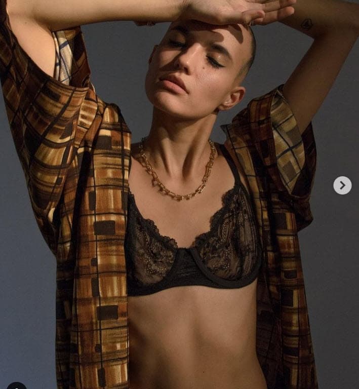 Un mes después de haberse rapado, apareció en estas fotos y escribió: "Nunca me hubiera imaginado dejar que alguien más que un médico me tomara una foto del cuero cabelludo para estudiar mi condición". 
<br>