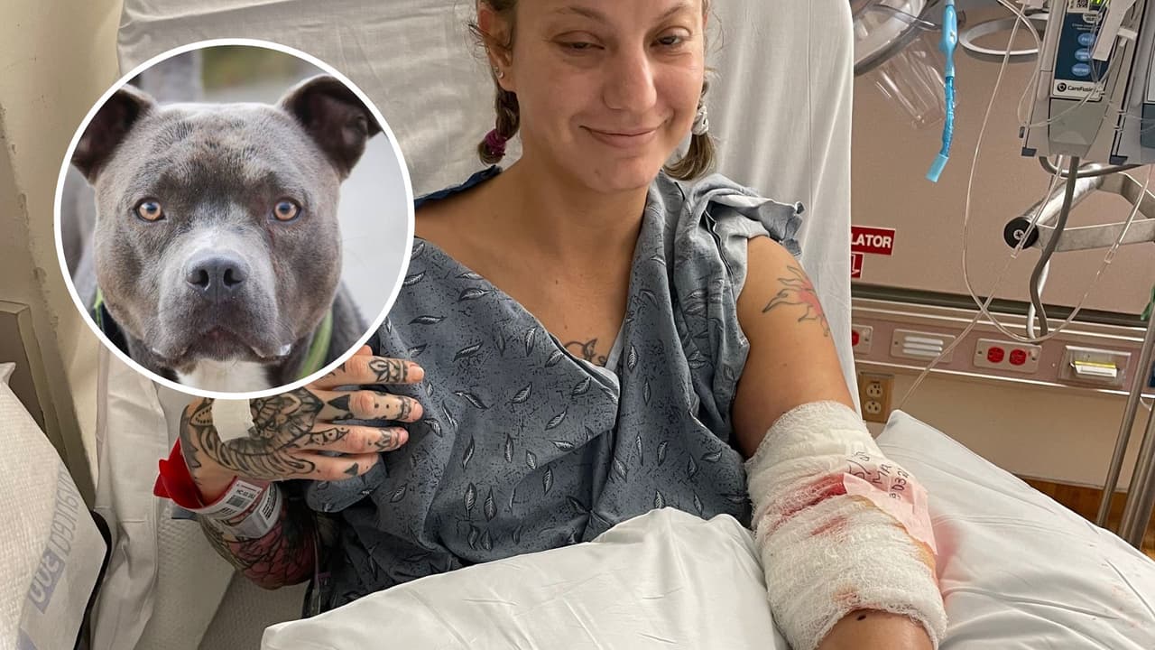 Madre de familia a punto de perder su brazo tras ser atacada por un perro pitbull en Villa Rica