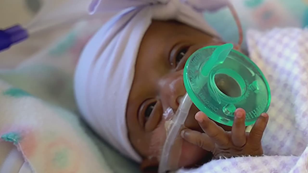 Su peso es similar al de una manzana y es considerada la bebé más pequeña del mundo