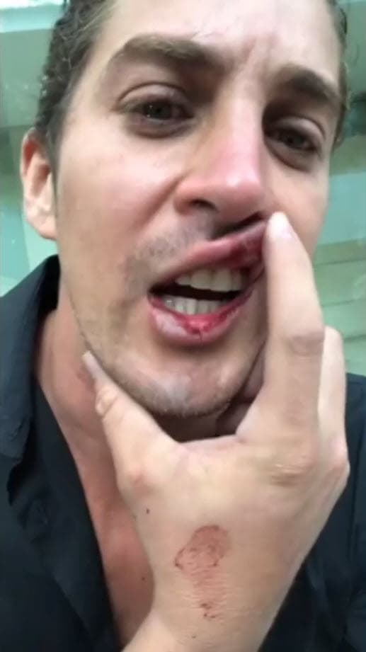 Luego, mientras mostraba lo que dijo eran heridas en su boca, acusó a la actriz: "A toda la gente que no denuncia, ayer la señorita 
<b>Fabiola Campomanes por drogada y borracha me empezó a pegar y me rompió toda la boca</b>, ya viene la policía, ya viene el 911 para denunciar. No se dejen jóvenes, hay personas que por más que quieran terminan así, gracias".