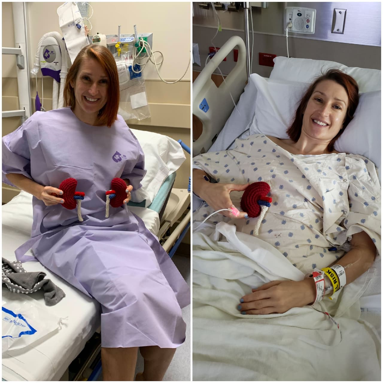 El Registro Nacional del Riñón es un registro nacional en los Estados Unidos que enumera a los donantes y receptores de riñón que necesitan un trasplante de riñón.