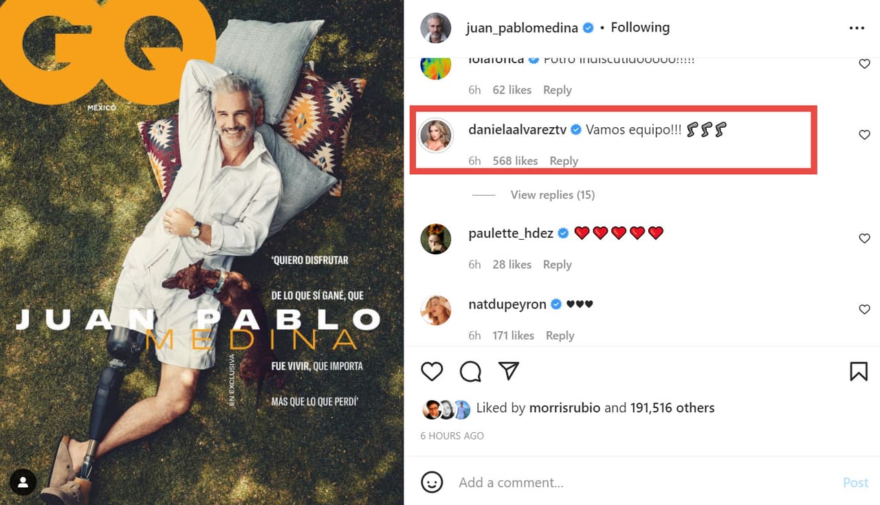 Juan Pablo Medina posa con su prótesis en la pierna y Daniella Álvarez reacciona.