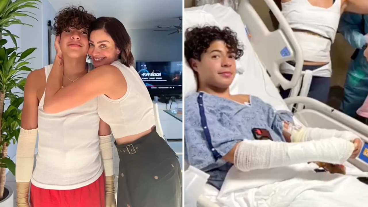 Sobrino de Dayanara Torres recibe una "alegría" tras sufrir quemaduras por una explosión