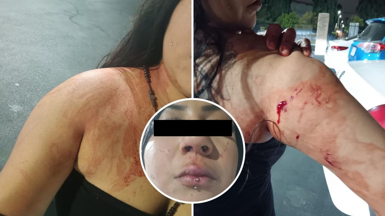Agresión en San José deja a mujer gravemente herida: todo queda captado en video