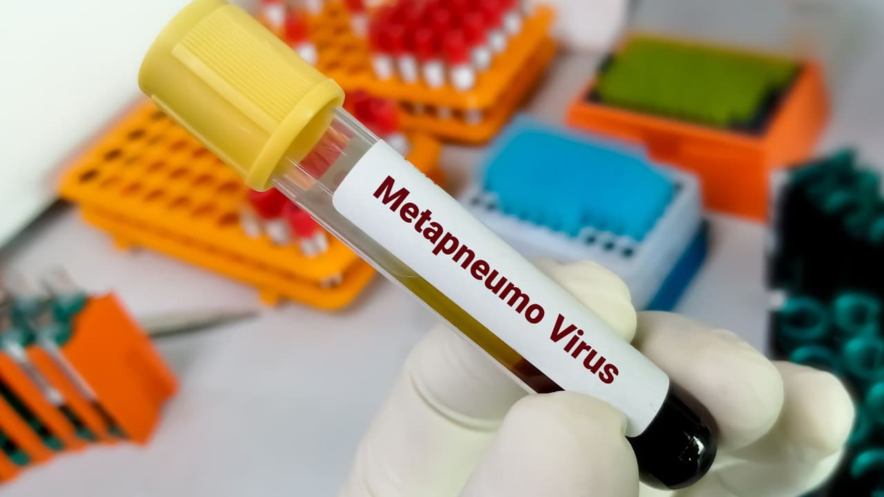 El 
<a href="https://www.univision.com/local/san-francisco-kdtv/metapneumovirus-sintomas-enfermedades-respiratorias">metapneumovirus</a> afecta especialmente a niños pequeños, adultos mayores y personas con sistemas inmunitarios debilitados, indican los Centros de Prevención y Control de Enfermedades (CDC). 
<br>