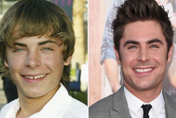 Aunque está tan bombón, que le hubiéramos perdonado esos dientes.