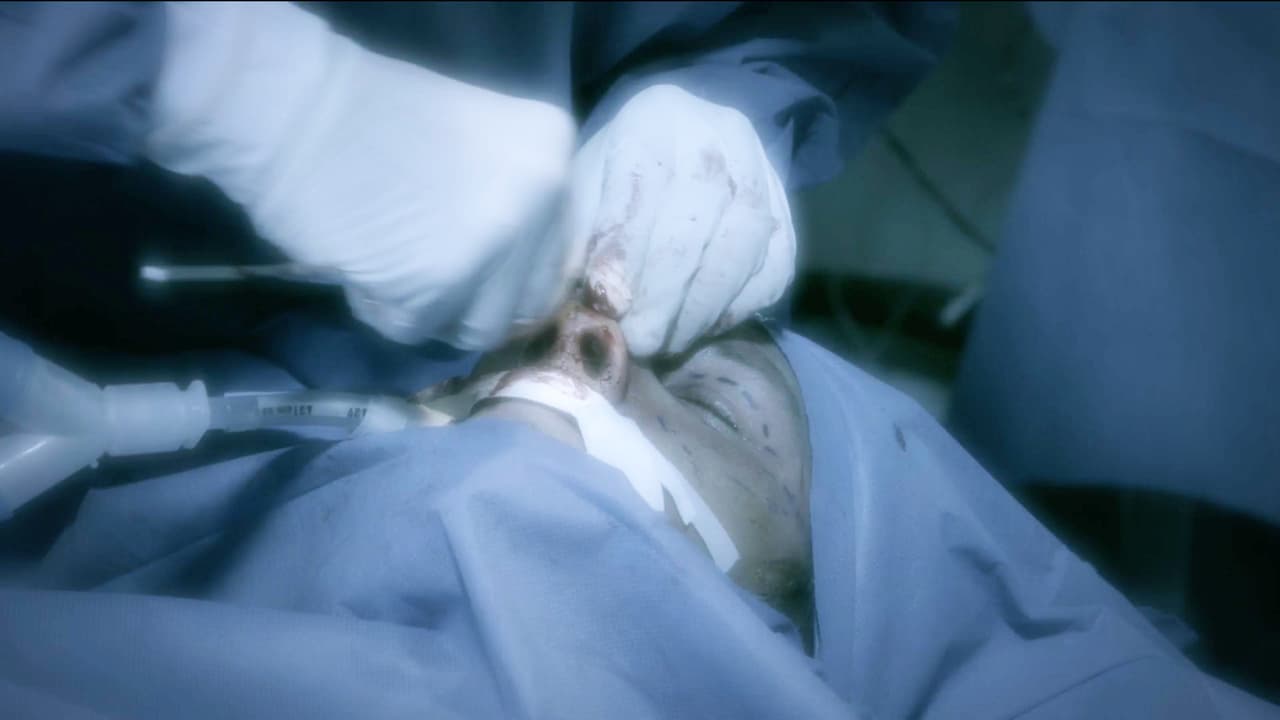 Recibió terribles golpes que le deformaron la cara.