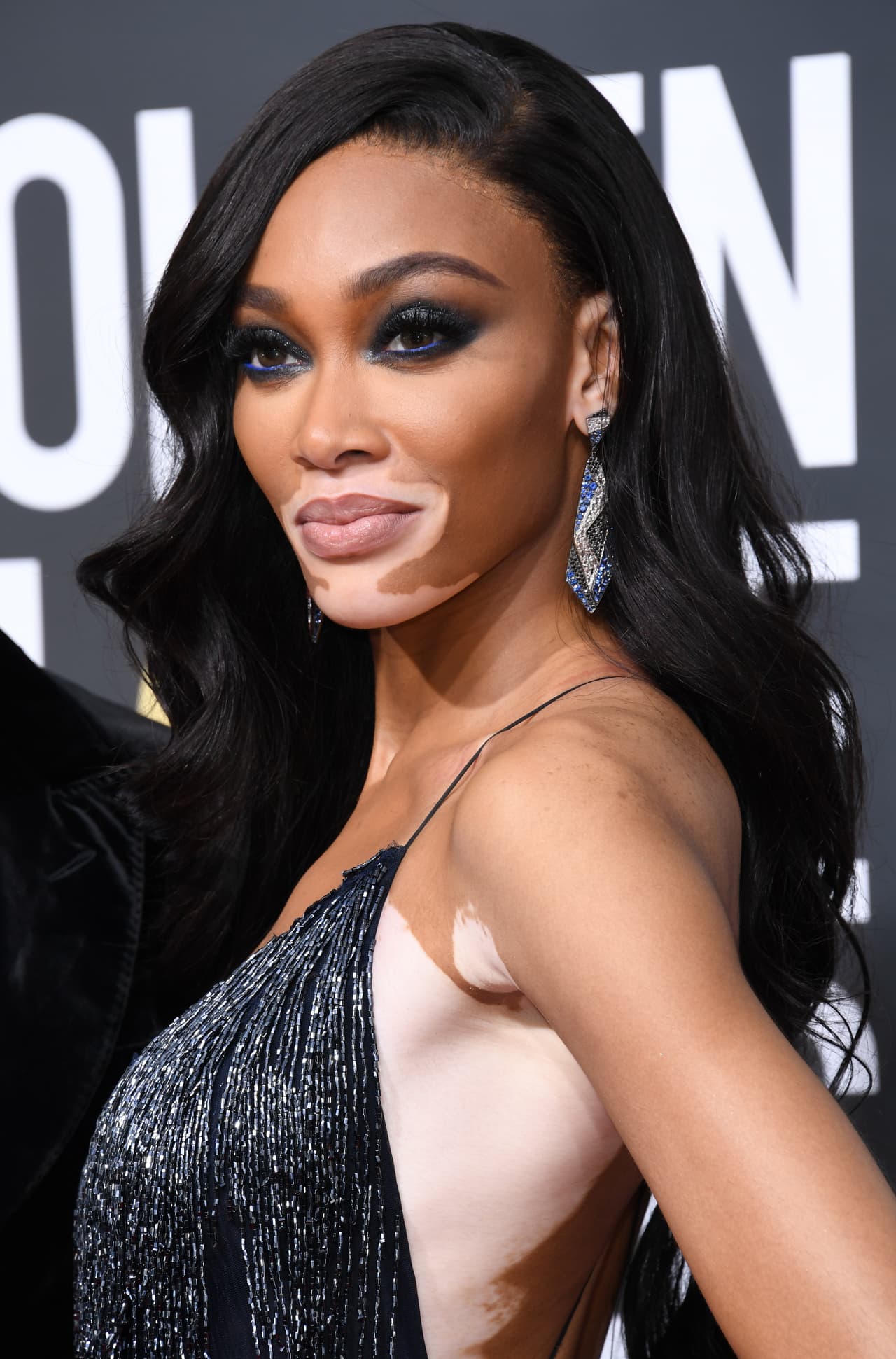 Winnie Harlow